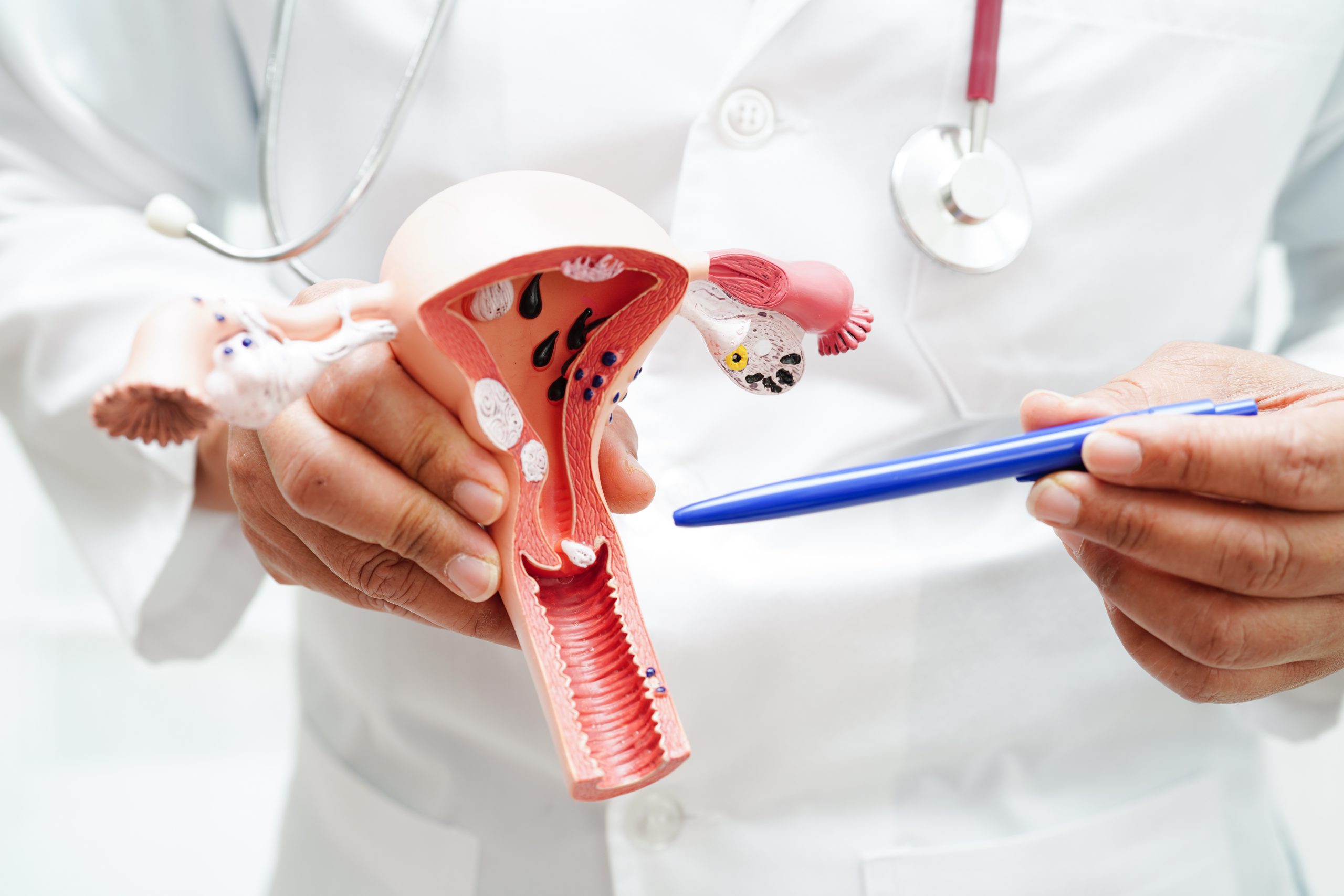 Screening-Stopp im Alter: Studie warnt vor Risiken